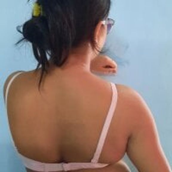 mast_CPL