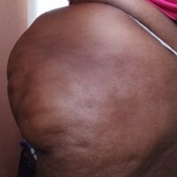 Babybigbutt
