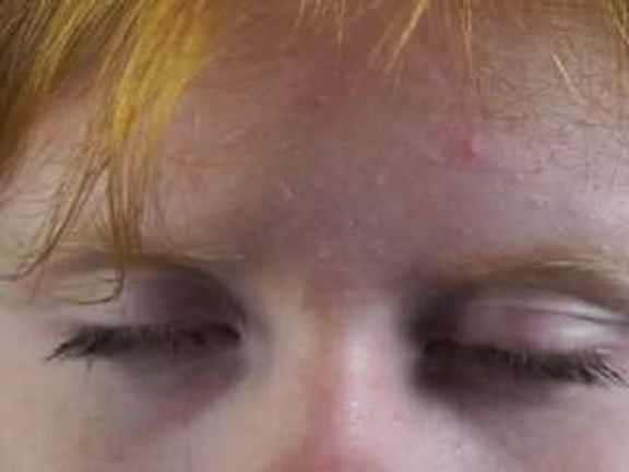 EadlinCheesman
