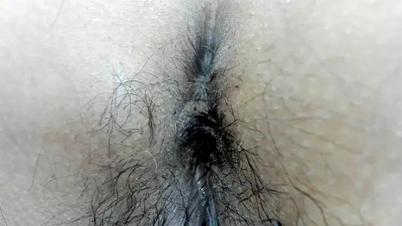 moxa_hot