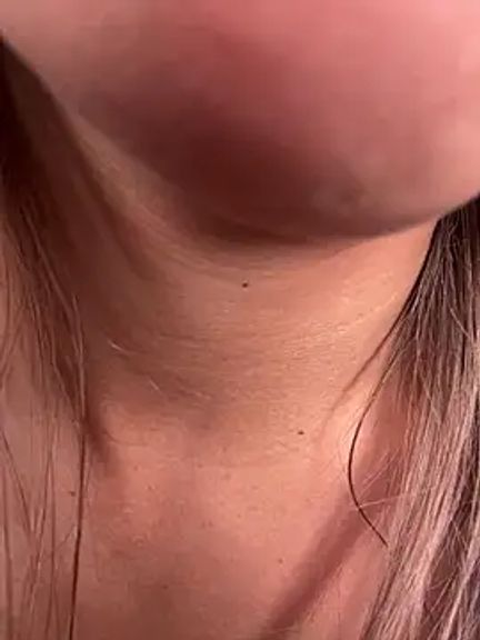 AliceStone19