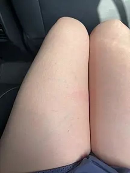 lotusannie99